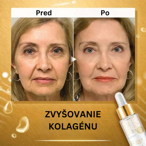 24K ZLATÉ KOLAGÉNOVÉ BOOSTER SÉRUM (Exkluzívna ponuka dnes: Kúp 1 a získaj 2 zdarma 🎁)