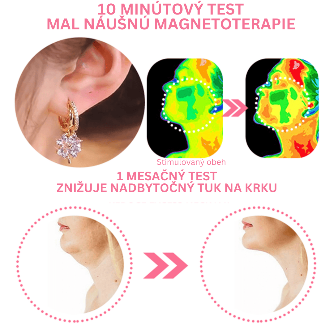 Náušnice flysmus™ Lymphvity MagneTherapy (Exkluzívna ponuka dnes: Kúp 1 a získaj 2 zdarma 🎁)